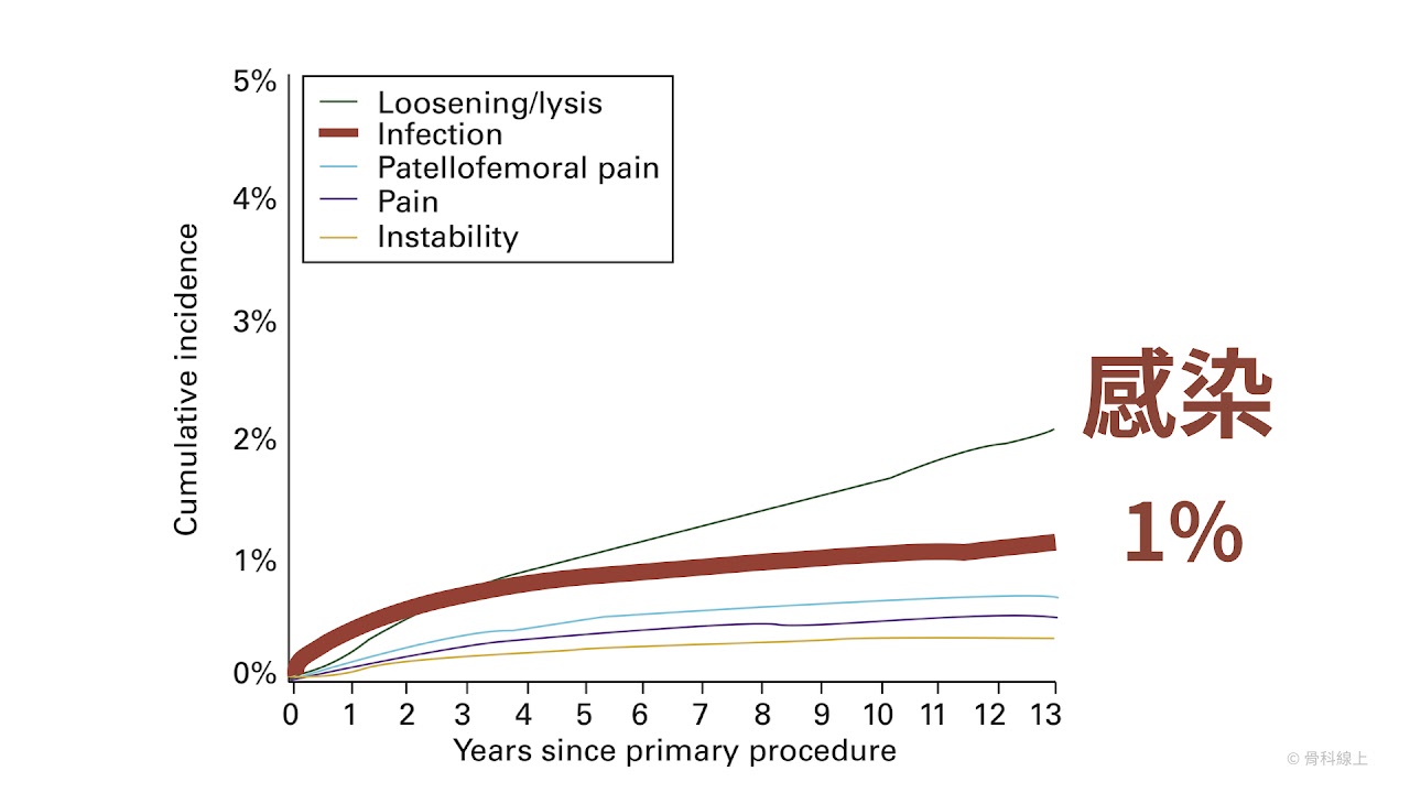 資料來源：2014年澳洲國家級關節登錄資料庫年度報告