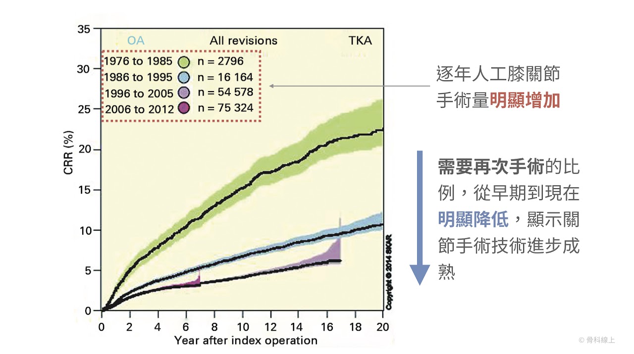 資料來源：2014年瑞典國家級關節登錄資料庫年度報告 