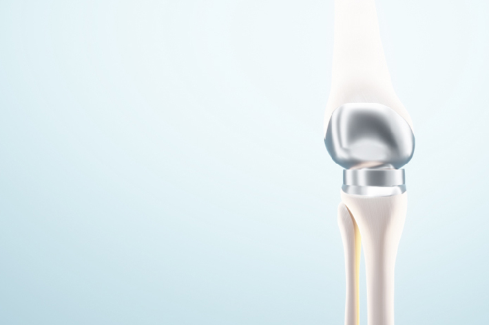 微創人工膝關節置換術